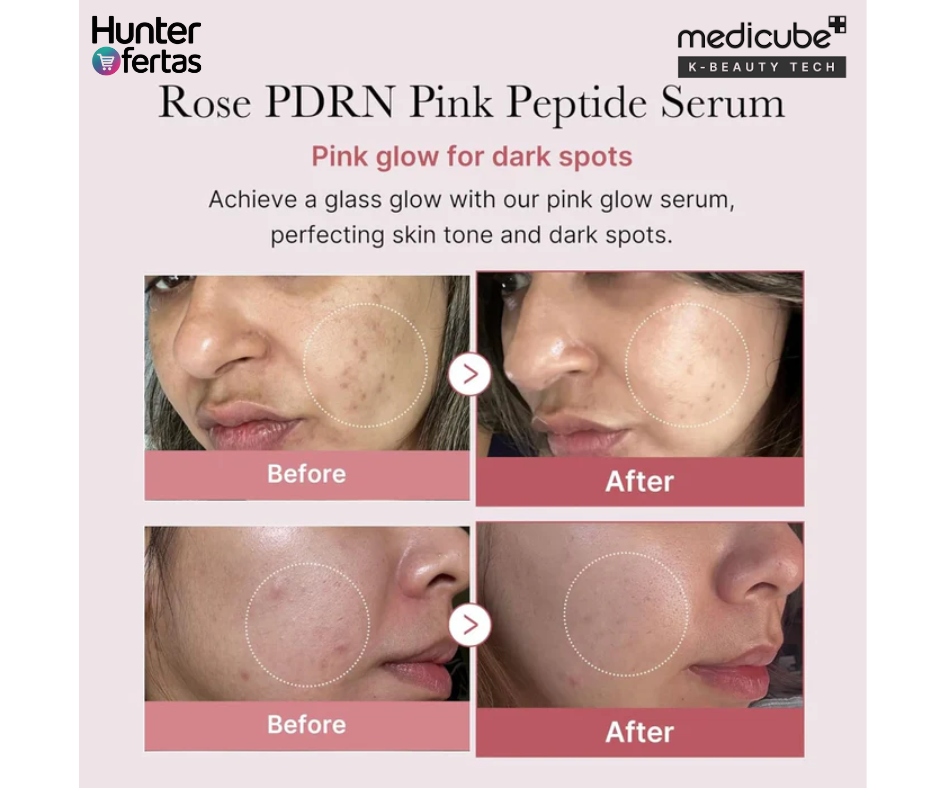 SERUM COREANO DE SALMON MEDICUBE PDRN